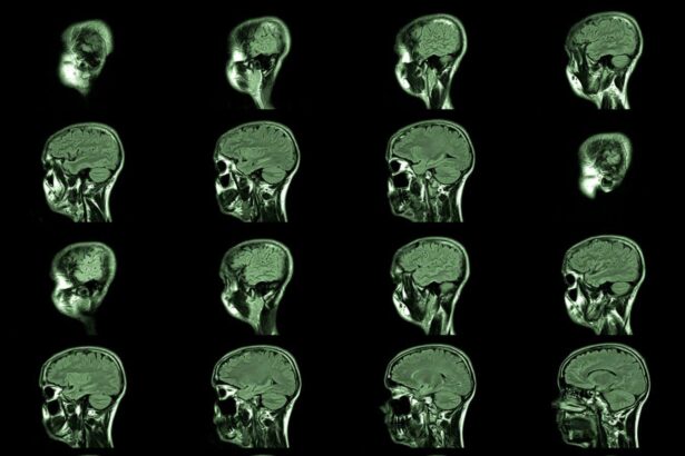 Cannabis derails train of thought, but may not affect long-term memory