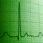 Researchers Try to Tie Cannabis to Irregular Heartbeats, Opposite Turns Out True
