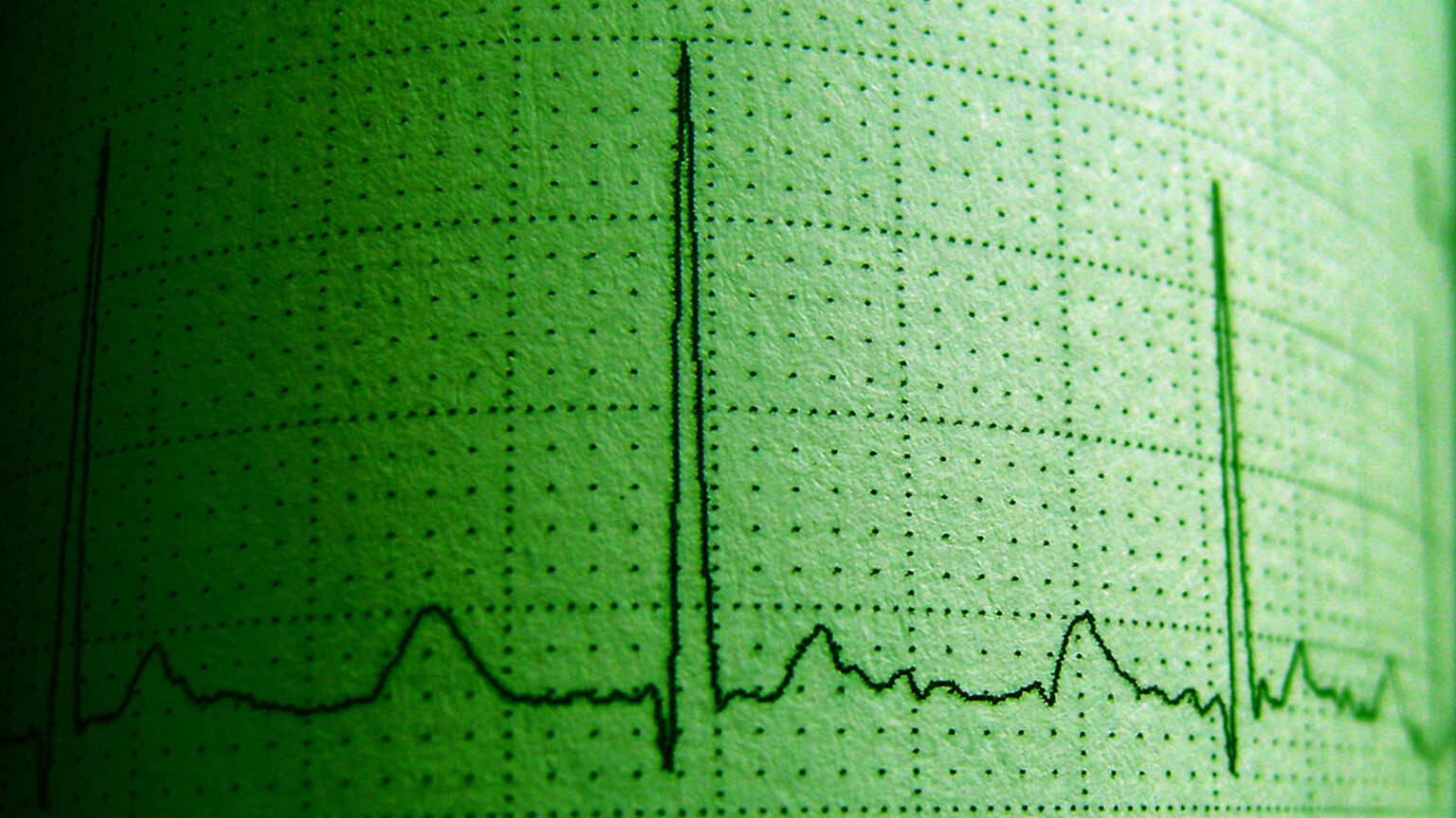 Researchers Try to Tie Cannabis to Irregular Heartbeats, Opposite Turns Out True