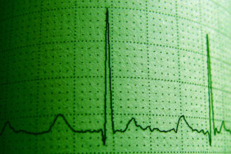 Researchers Try to Tie Cannabis to Irregular Heartbeats, Opposite Turns Out True