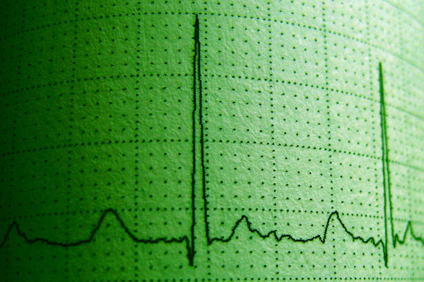 Researchers Try to Tie Cannabis to Irregular Heartbeats, Opposite Turns Out True