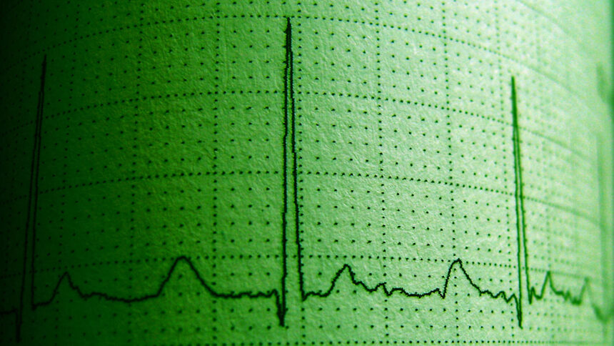 Researchers Try to Tie Cannabis to Irregular Heartbeats, Opposite Turns Out True