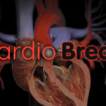 TMVR Systems Pulled for Burst Balloons; Cannabis-VTE Paradox; Beets for BP